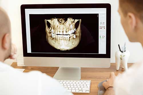 3D Zahnröntgen
